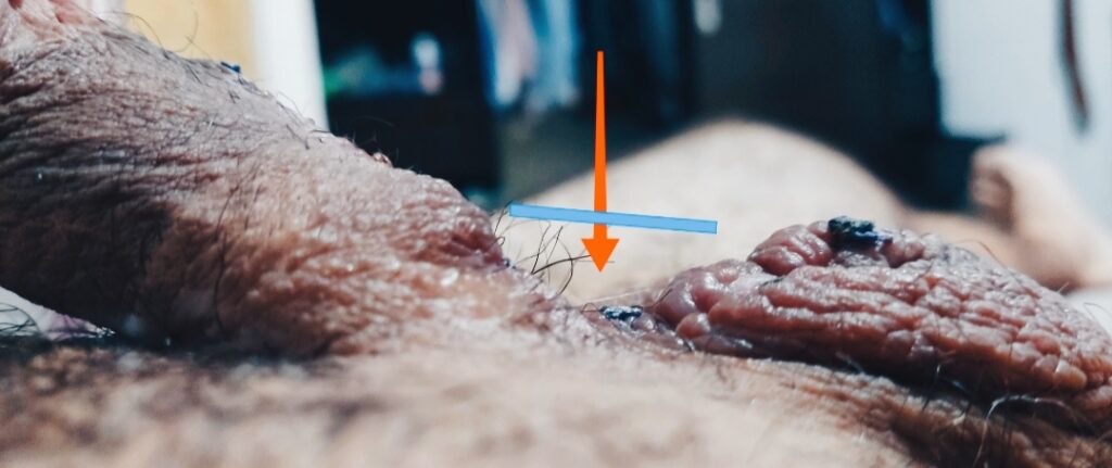 urologo mariano oropeza